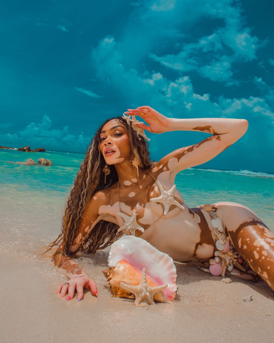 Η Winnie Harlow το μοντέλο που «σαρώνει» στο χώρο της μόδας έκλεψε τις εντυπώσεις με το πιο αποκαλυπτικό μαγιό δια χειρός Celia Kritharioti